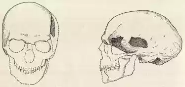 chapter-II-plate1a